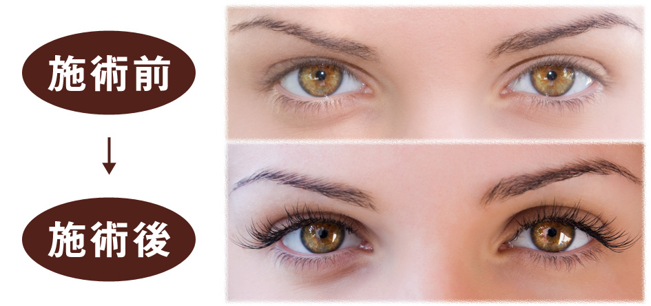 施術前から施術後のイメージ